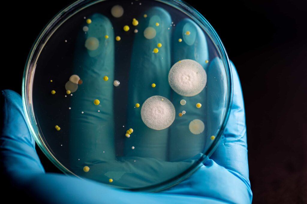 Gloved hand holding lab plate containing mold.